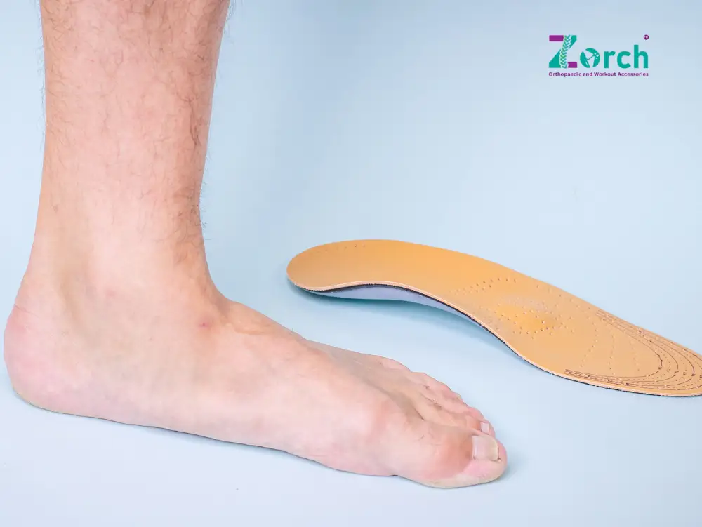 Flat foot next to Zorch arch support insole for flat feet treatment