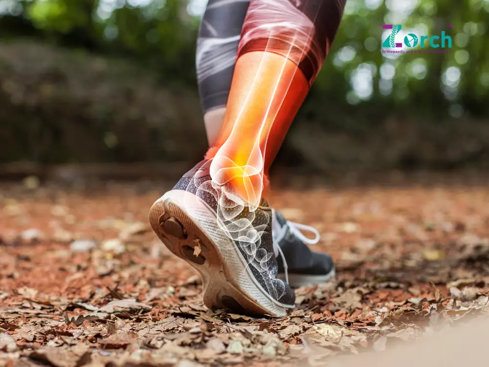Runner experiencing ankle twist with visible bone and joint inflammation overlay, illustrating common ankle pain causes like sprains, tendonitis, and stress fractures, along with the need for early ankle pain treatment.